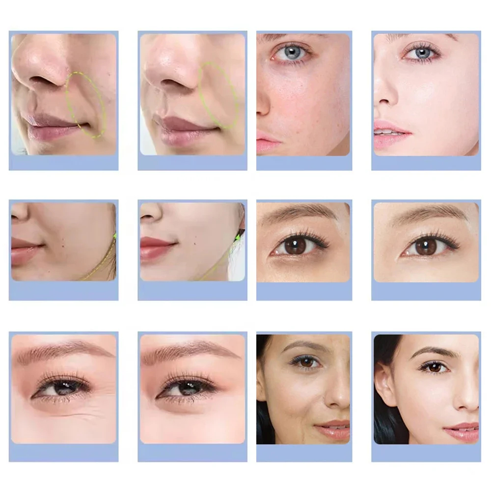 7 ประเภทเครื่องฟองออกซิเจน CO2 - Aha Bha Exfoliant บทวิจารณ์และราคา