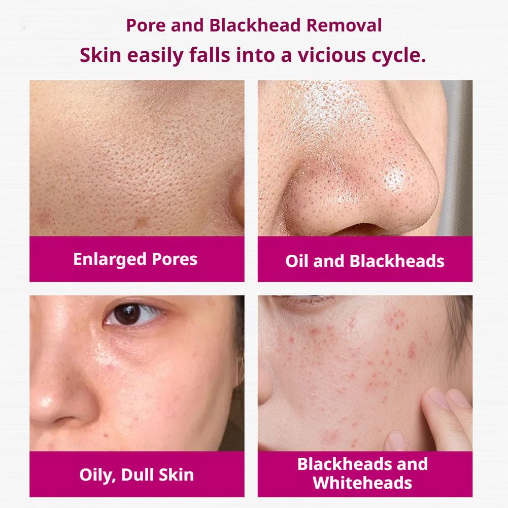 เซรั่มกรดซาลิไซลิกกระชับรูขุมข - Aha Bha Exfoliant บทวิจารณ์และราคา