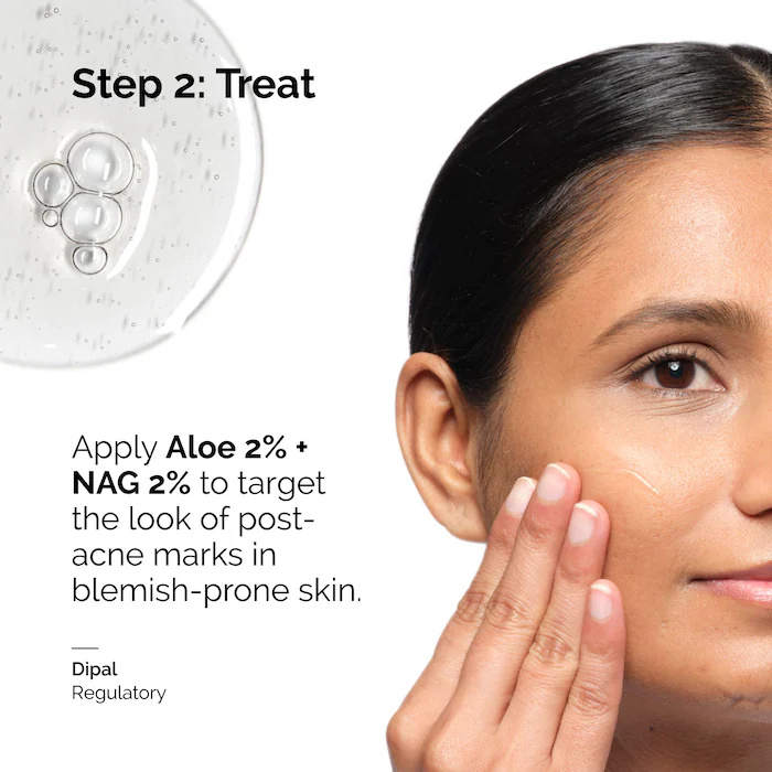 เซรั่มว่านหางจระเข้ 2% + NAG 2 - Aha Bha Exfoliant บทวิจารณ์และราคา