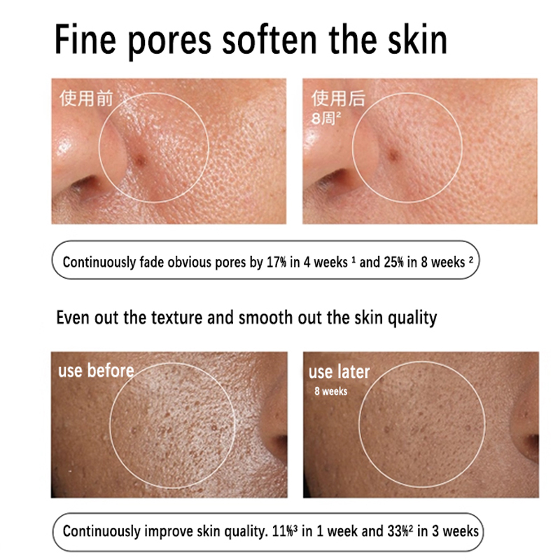 เซรั่มว่านหางจระเข้ 2% + NAG 2 - Aha Bha Exfoliant บทวิจารณ์และราคา