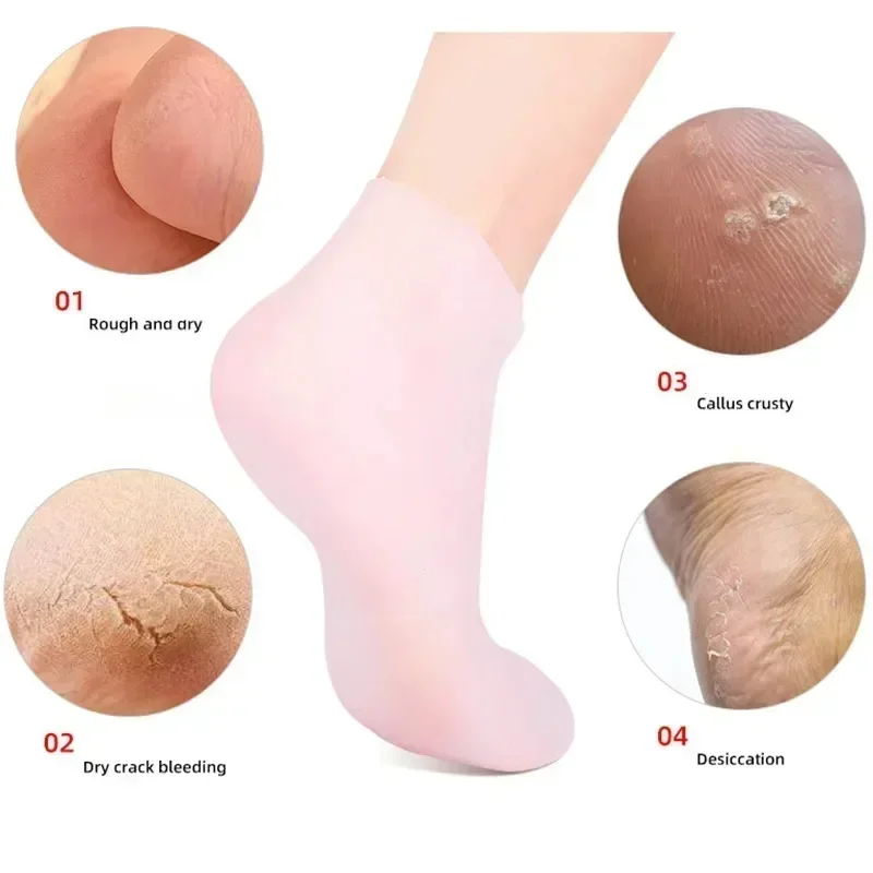 1 คู่ซิลิโคน Moisturizing ถุงเ - Aha Bha Exfoliant บทวิจารณ์และราคา