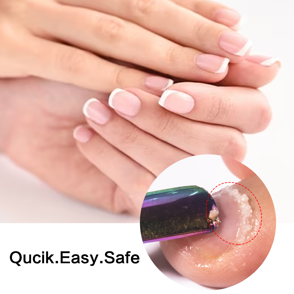 KODIES GEL Cuticle Remover 15M - Aha Bha Exfoliant บทวิจารณ์และราคา